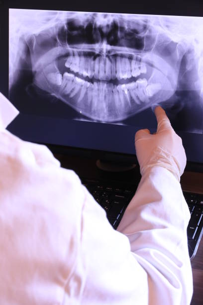 Best Emergency Dental Care for Broken or Chipped Teeth in Heathcote, NJ